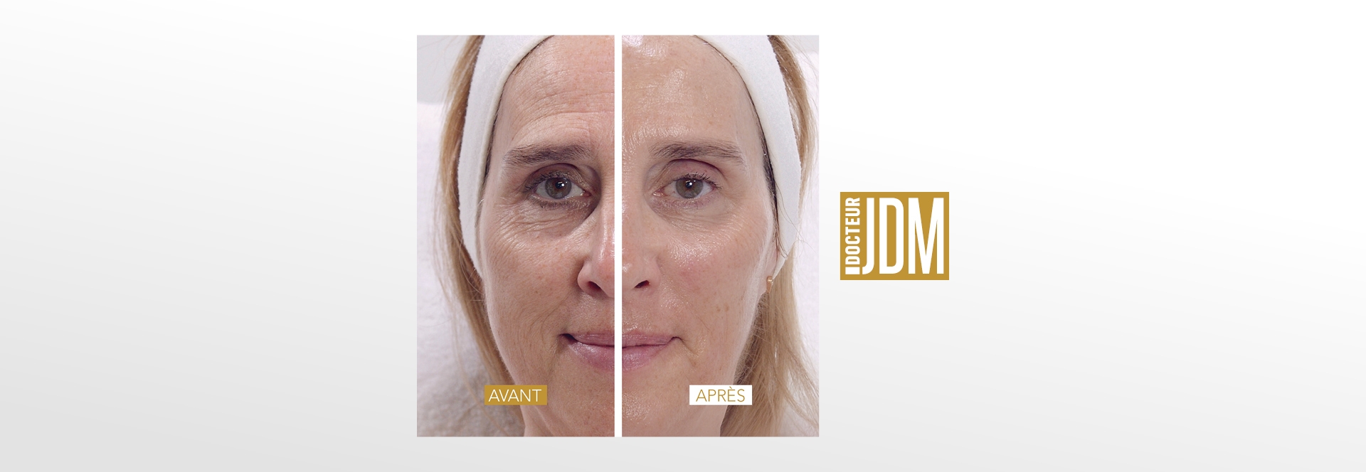 Tratamiento Visible Age Reverse creado por Doctor JDM